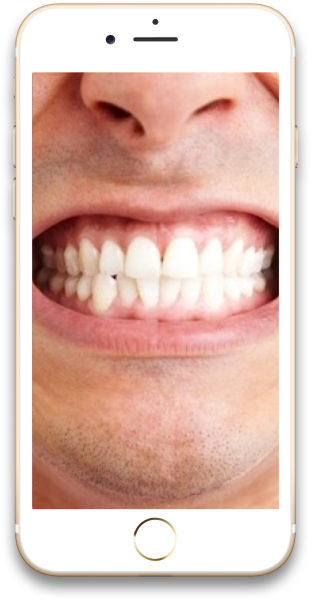 Ortholuna - Stuur je foto en krijg gratis advies